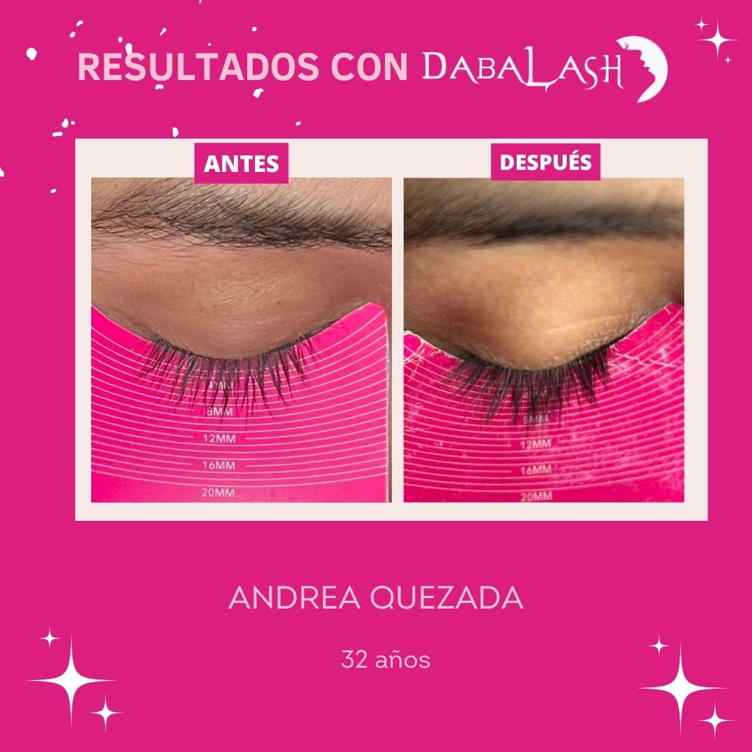 Testimonios de crecimiento de pesta&ntilde;as 